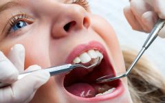 غفلت از دندان شیری، عامل اصلی ارتودنسی‌های پرهزینه و اختلال در رشد کودکان است